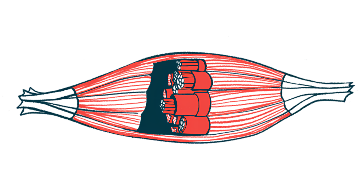 Ilustração anatômica de um músculo esquelético com destaque para fibras musculares e unidades motoras, representando como os padrões de ativação muscular no Parkinson são diferentes em mulheres e homens, com foco na irregularidade da contração e na variabilidade do disparo nervoso.